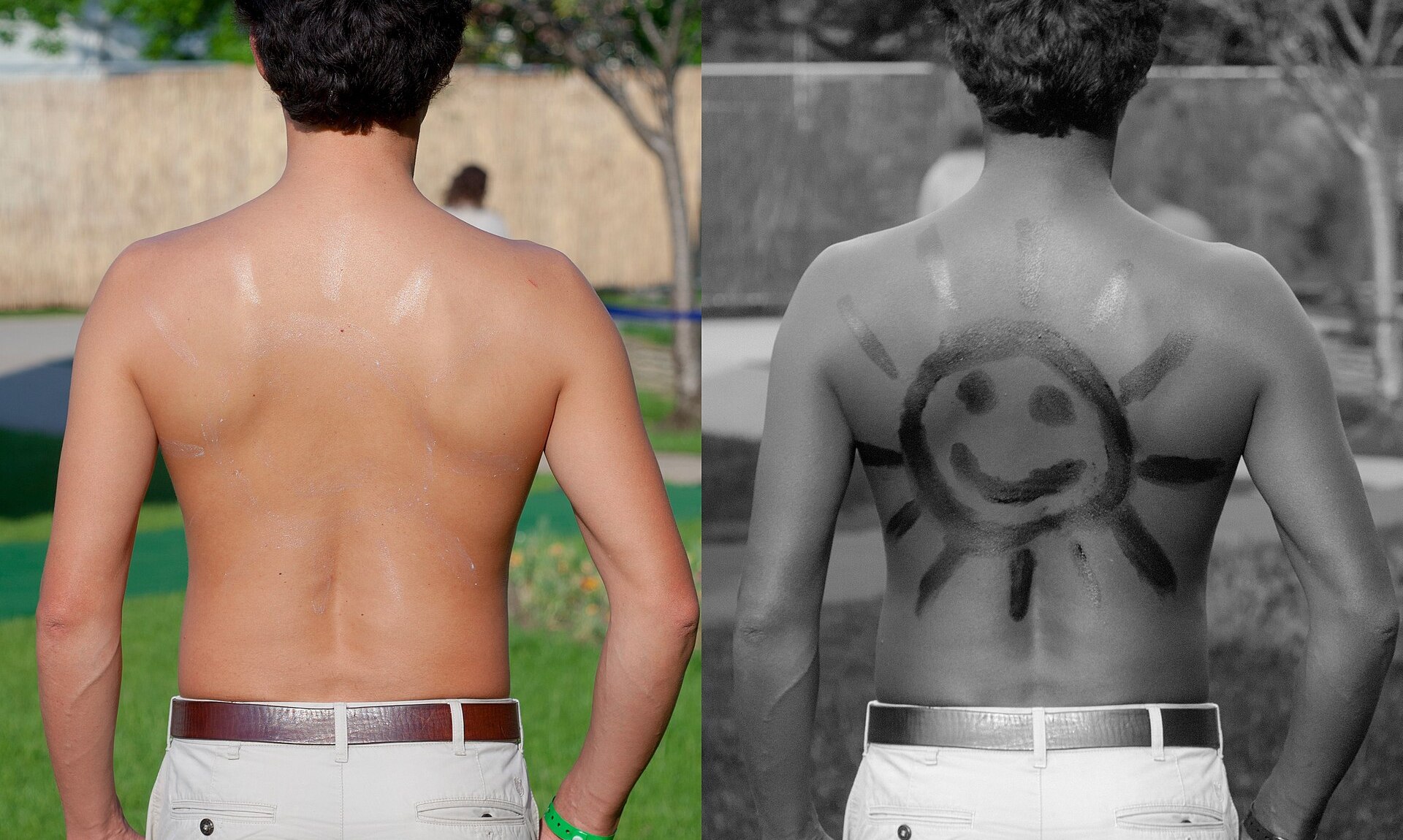 Duas fotos das costas de um homem: em luz normal a pele parece sem nada; em luz ultravioleta aparece o desenho de um sol feito com protetor solar